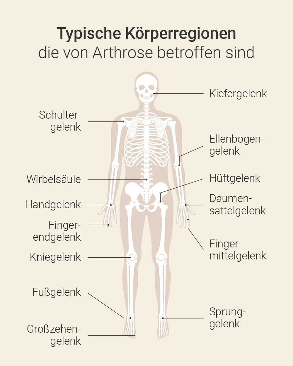 Arthrose­therapie Frankfurt